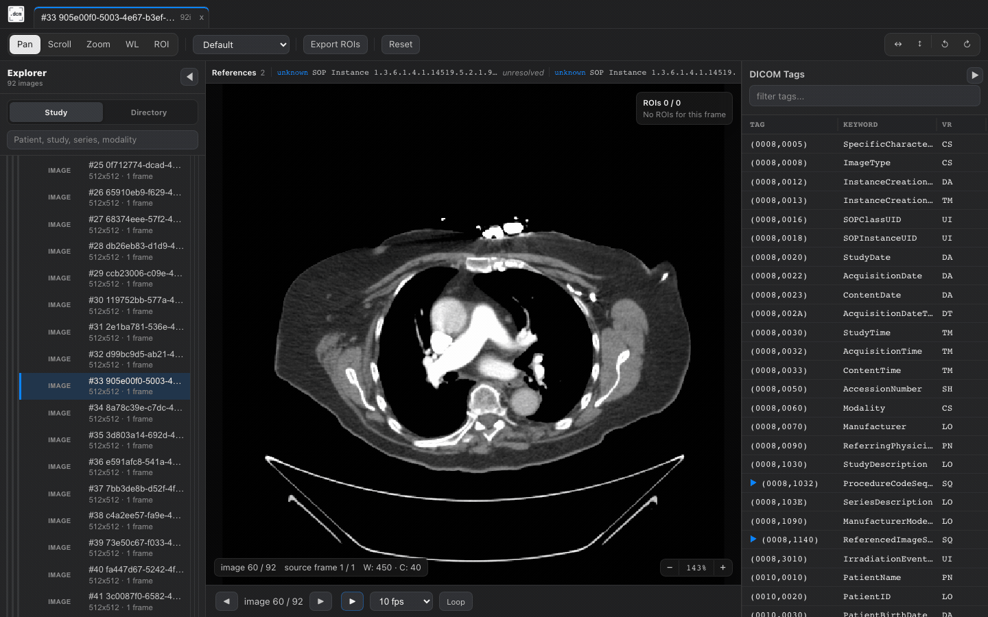 Chest CT cine playback in dcmview