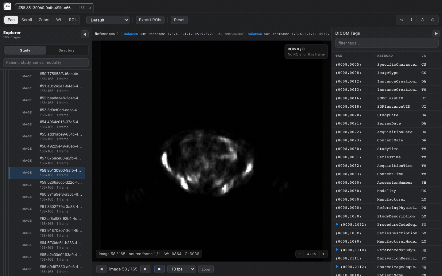 PET cine playback in dcmview