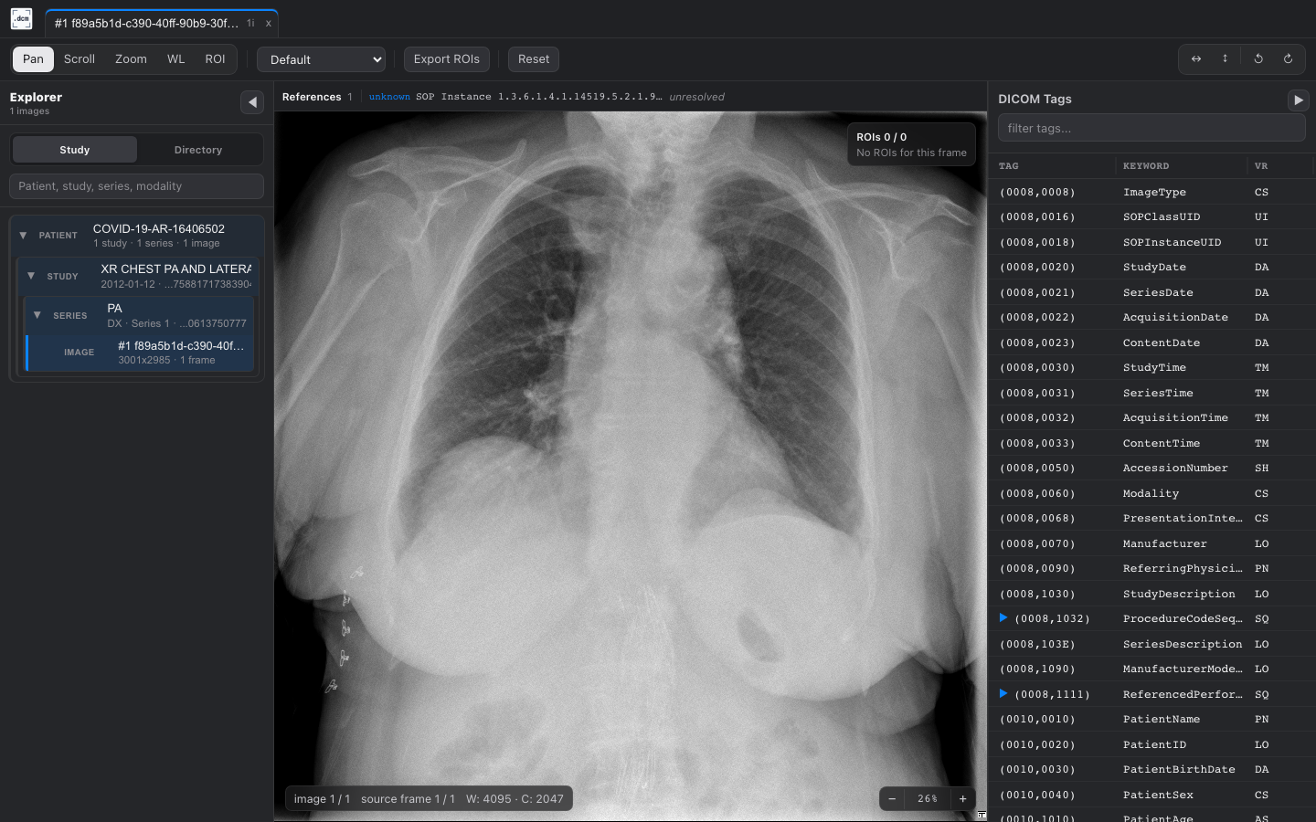 Chest radiograph in dcmview