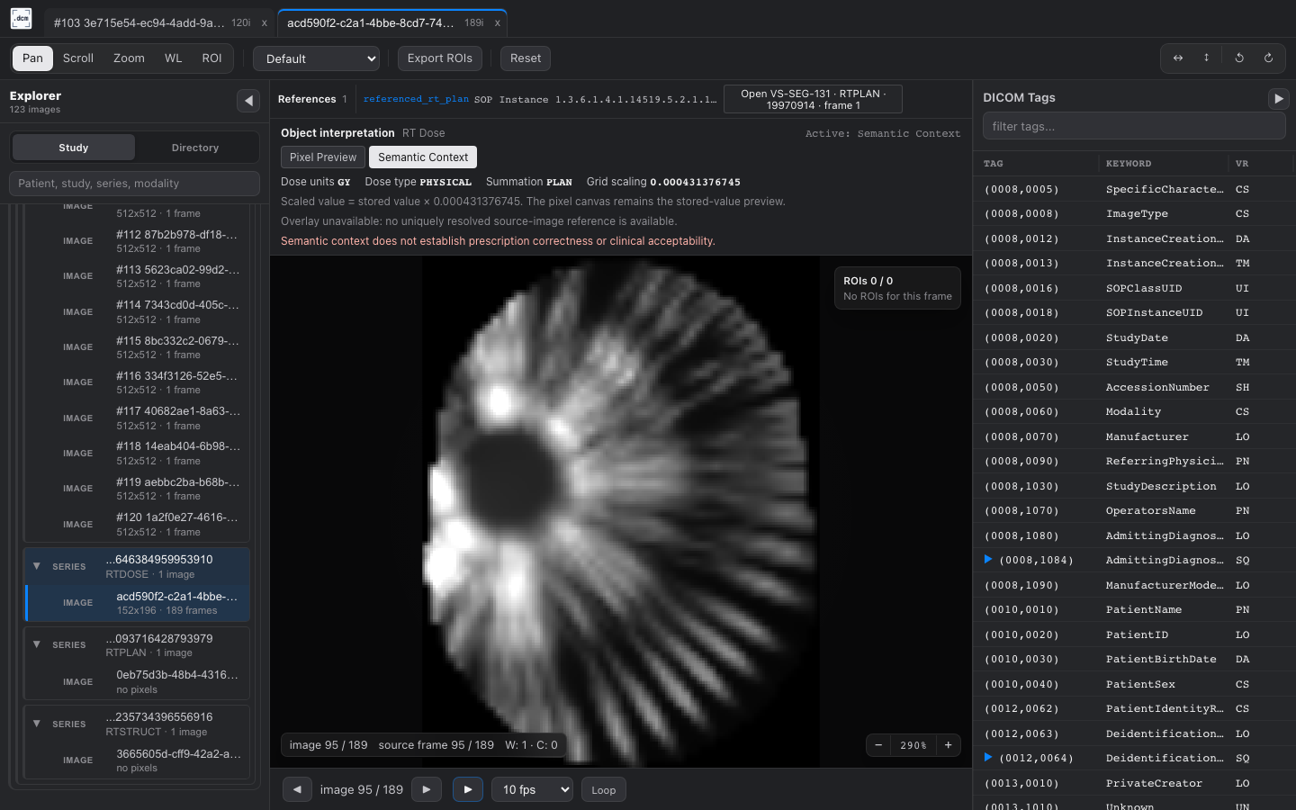 RT Dose semantic context in dcmview